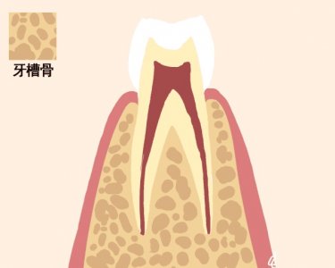 ​深覆合对面部美观的影响有哪些？