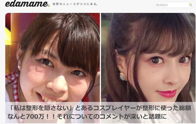 日本年轻女人整容前后对比（日本妹子花700万整成小仙女）(14)