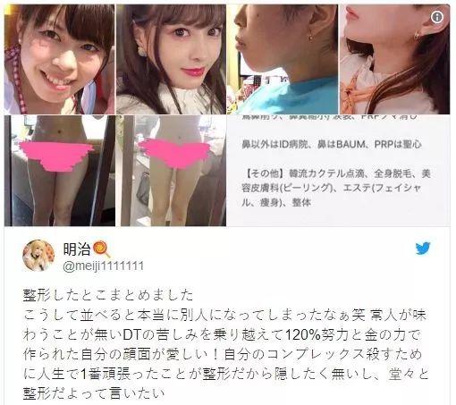 日本年轻女人整容前后对比（日本妹子花700万整成小仙女）(4)