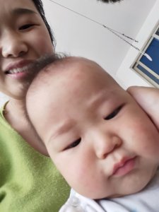 ​经历幼儿急疹的五天五夜